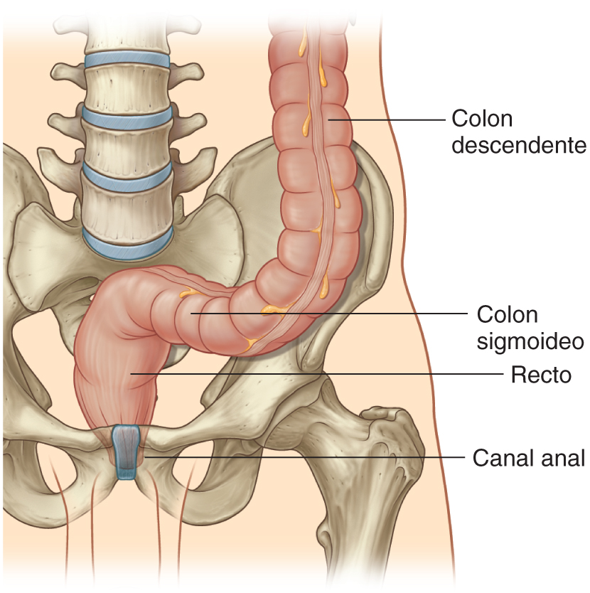 PasionAnatomia's tweet image. El #ColonSigmoide sigue un recorrido en forma de S de longitud variable y está localizado en la cara superior de la #FosaIlíaca izquierda. Desciende en contacto con la pared izquierda de la pelvis y, a continuación, atraviesa la cavidad pelviana, donde se continúa con el #recto