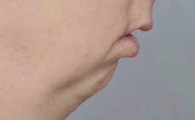 "but bitcoin has no real value"