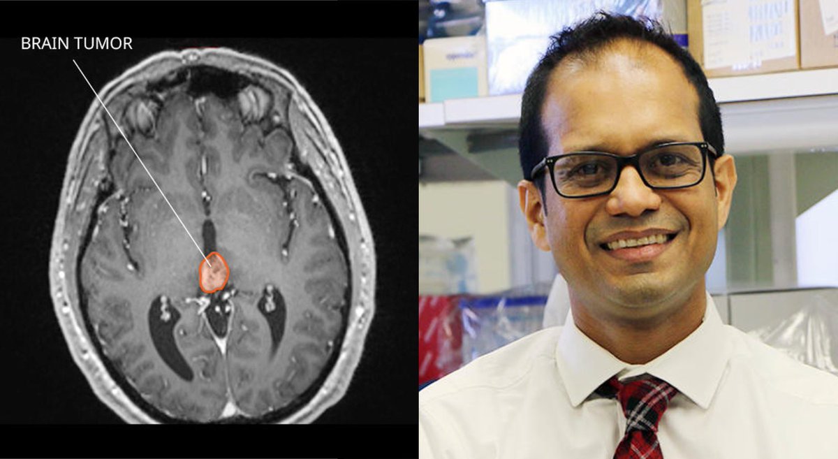 Each year, an estimated 81 adults in the United States are diagnosed with a pineal region tumor. To better understand these rare tumors, #NCIconnect is collaborating with clinicians across disciplines, including Dr. Prashant Chittiboina from @NIH_NINDS: go.cancer.gov/5IsT3Al