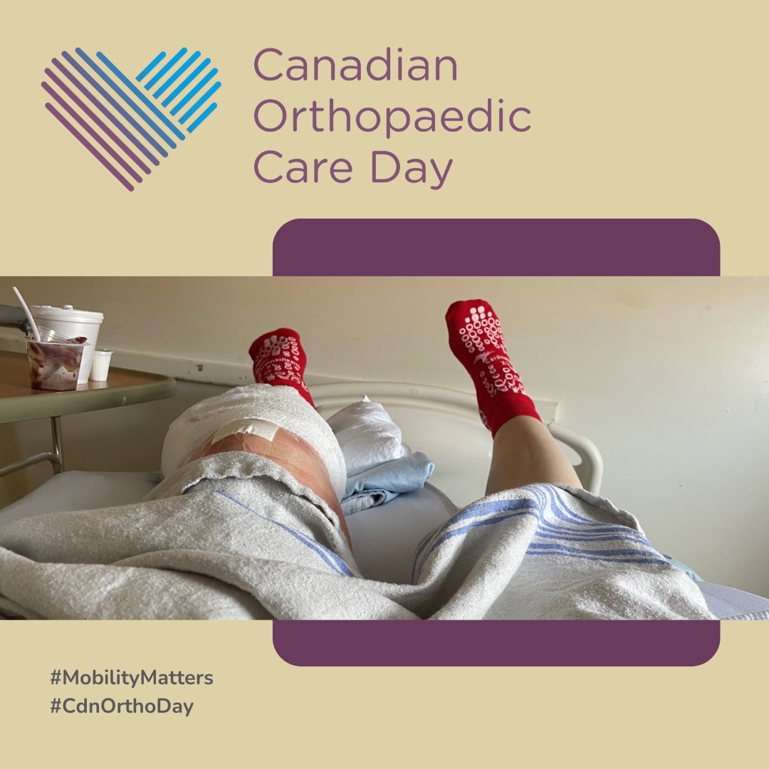 On this #CdnOrthoDay I want to share an impactful day in my orthopaedic journey I refer to as Red Sock Day – the day physio socks were put on my feet & I had to stand up for the first time post fx +surgeries, bear weight & try to walk. #MobilityMatters #MSKUnited #OrthoCareCanada