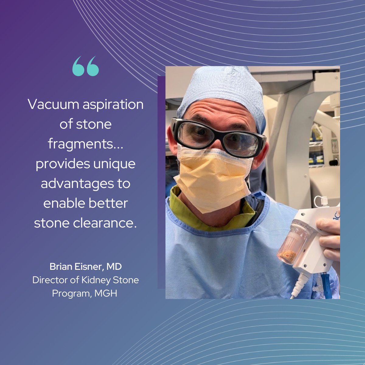 “Vacuum aspiration of #KidneyStone fragments during ureteroscopy with laser lithotripsy under direct visualization provides unique advantages to enable better stone clearance for our patients.' - @BEkidneystone @newtonwellesley @MGHUrology Learn about #CVACAspiration:…