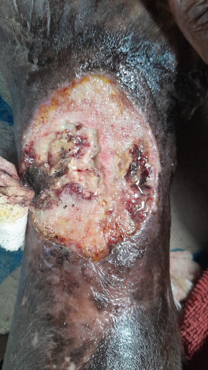 LinahSkhosana's tweet photo. @Anele Please help my mom, I don't have the funds to help her, I recently graduated, I was hoping I could find a job to help her soon but she is getting worse and I'm scared.0656473254 https://t.co/hSx1y4IB17