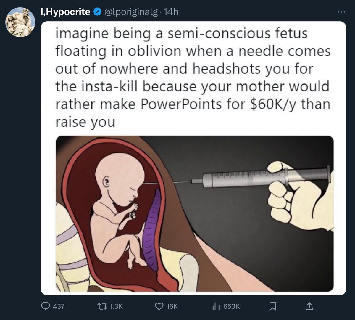 I don’t think that’s how abortions work