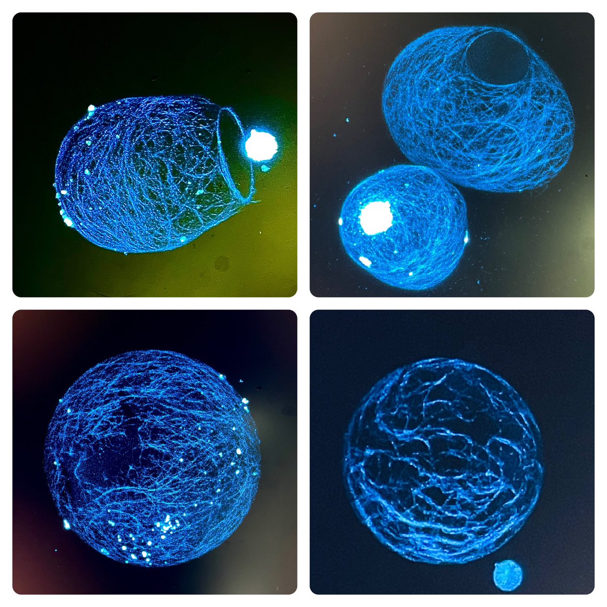 Honing my skills in capturing beautiful images of regenerated cell walls in plant protoplasts in Daniel Cosgrove’s lab at Penn state where each image tells a story of growth and resilience!