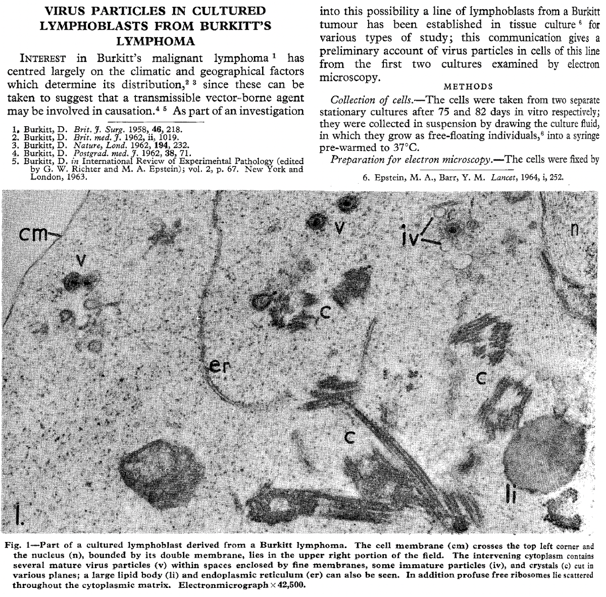 Today marks the 60th anniversary of the publication of the paper describing the discovery of Epstein-Barr virus (EBV), the first virus shown to cause cancer in humans. EBV is also implicated in multiple sclerosis and other autoimmune diseases.