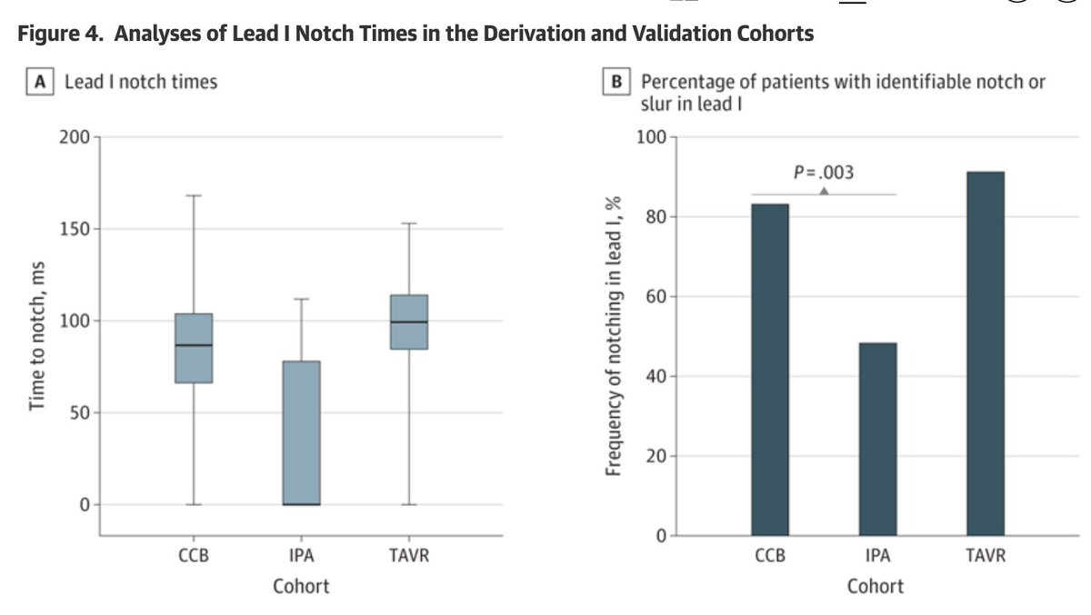 Nice work from the UC group led by @gauravaupadhyay on further defining LBB. Not just an exercise in academics. Imp for selection of CSP Time to notch in Lead 1 > 75msec looks the best discriminator in a clever analysis Wide QRS due to LBB not the same as wide due to IVCD