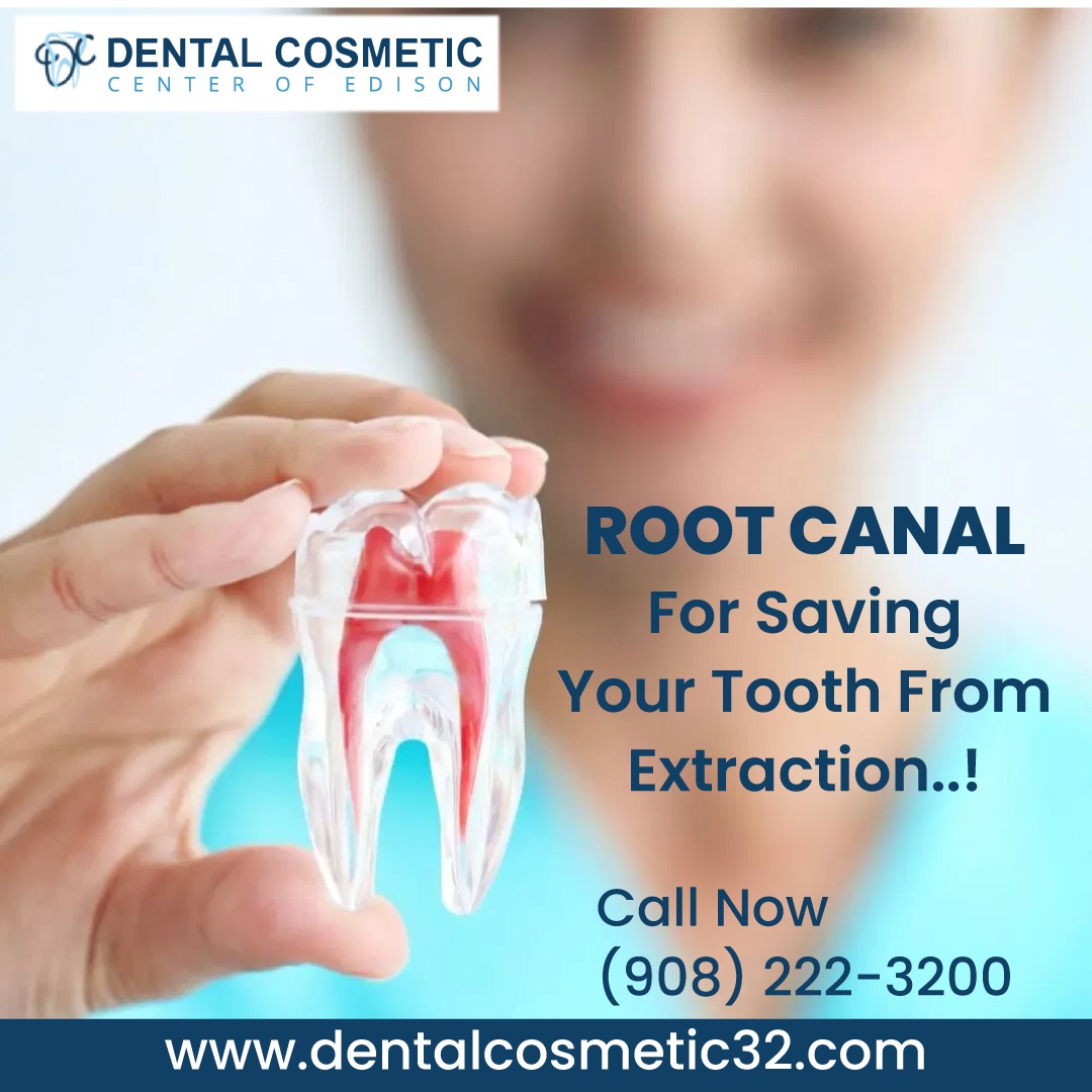 Save your tooth with a root canal! No need to worry about getting it pulled out. Keep smiling bright!

#dentalcosmetic #ToothPainRelief #RootCanalTreatment #DentalCare #SaveYourTooth #NoExtraction #HealthySmile #ToothSaver #OralHealth #SayNoToExtraction #KeepSmiling