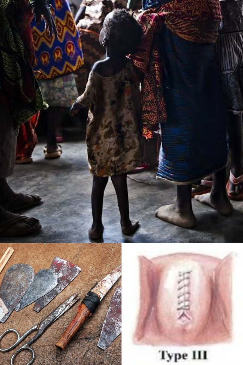 My #FGM Torture💔 'I Was Just 7 When My Genital Was To Be Sewn Up Without Anesthesia BUT My Mom Said, '...do not shame me, and do not scream!'' Fadumo Korn Recounts: 'I was genitally mutilated at the age of seven! When I saw the old, heavily flexed woman coming to the camp under