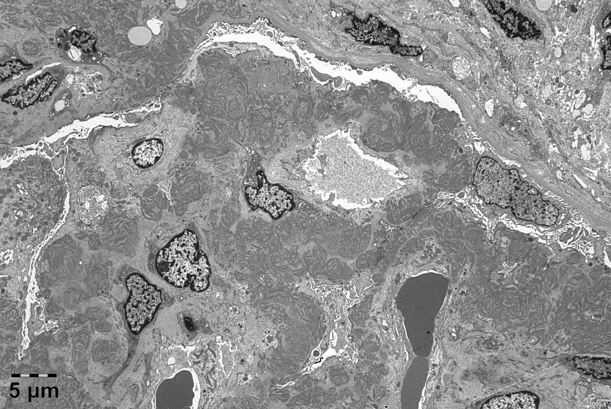 Wenyan Zhou tweet media