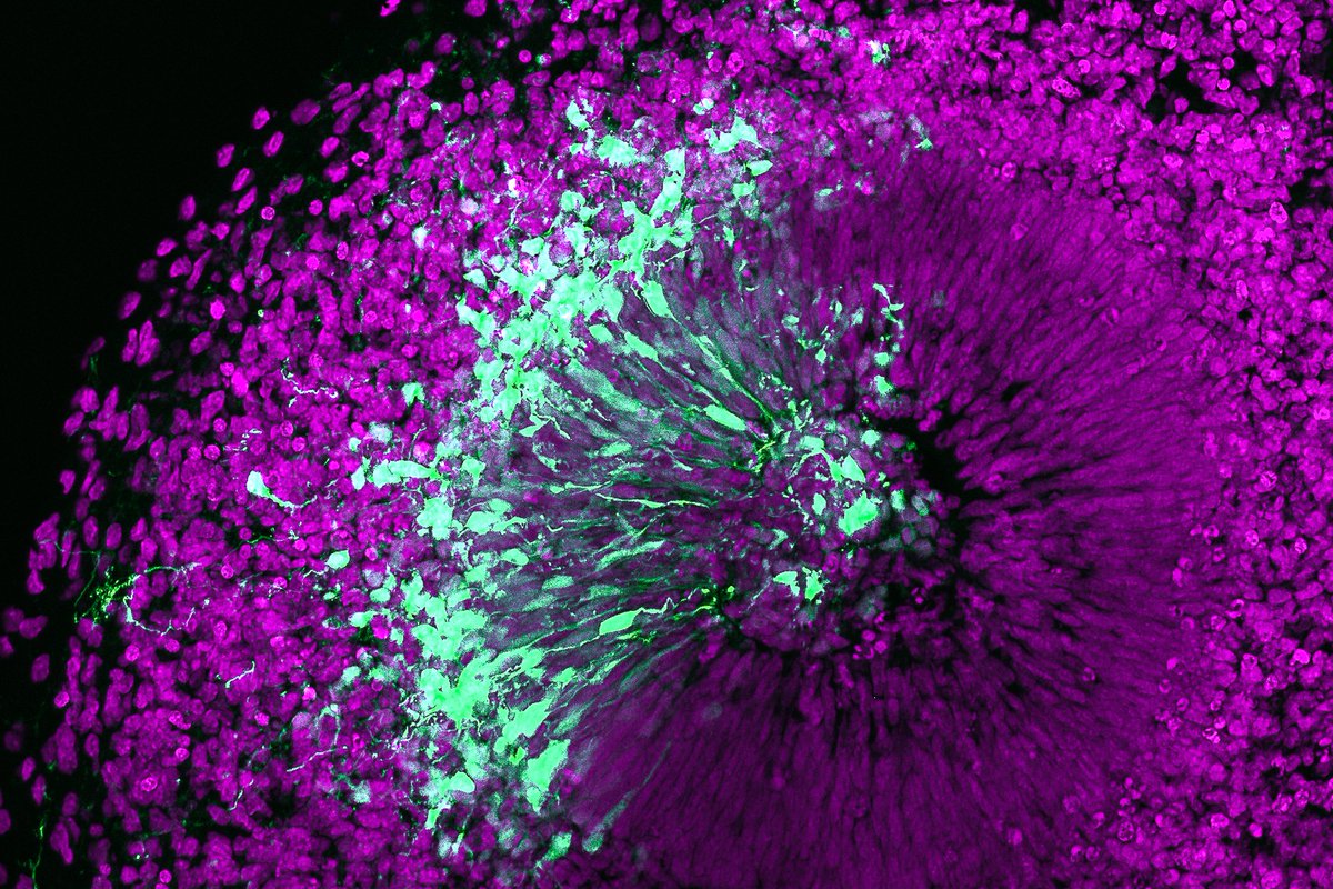Ein Forschungsteam unter der Leitung von @MareikeAlbert @tudresden_de hat einen neuen Wachstumsfaktor identifiziert, der zur Expansion des Neokortex beim Menschen beigetragen haben könnte. doi.org/10.1038/s44318… Bild: Janine Hoffmann