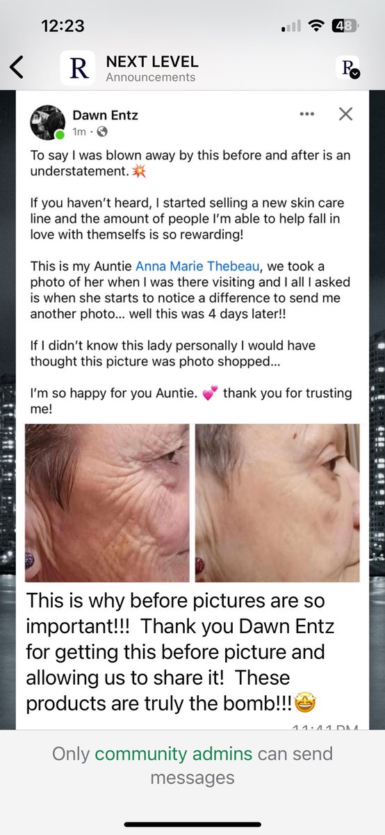 Basmati4u's tweet photo. #kbeauty #riman who wants help with… acne, wrinkles, rosacea, and eczema, psoriasis, dryness, redness, oily or combo skin and everything in between?!?! Hair loss, gut health and everything in between?!?! Message me! #Skin #haircare #selflove https://t.co/T3IwZektMr