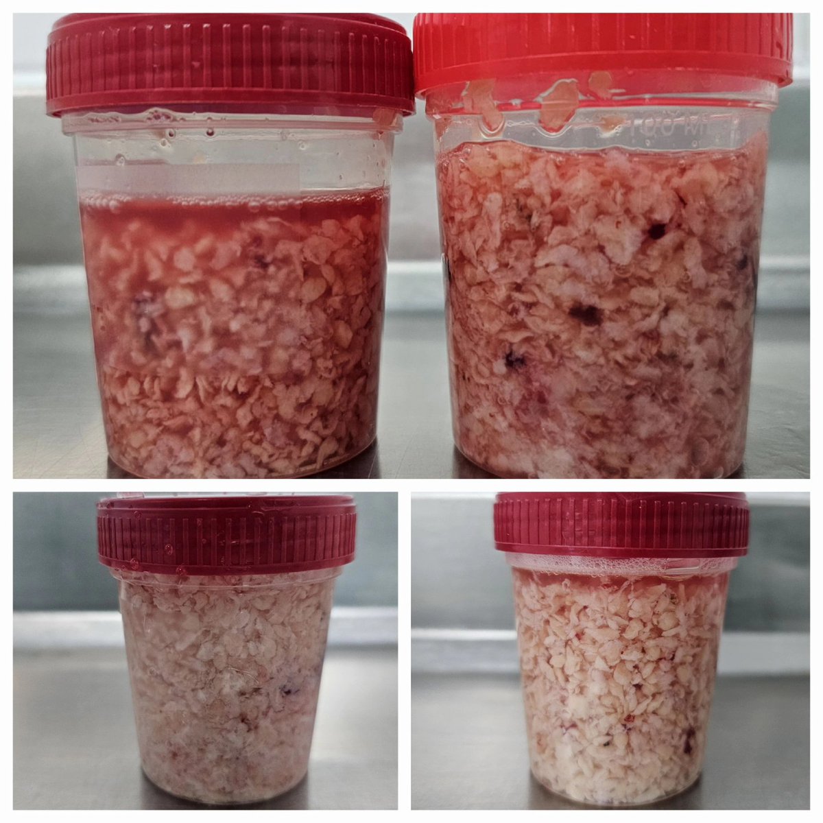 🔥 New HoLEP session with the #CCU team in Bahía Blanca, Argentina 

✅️  We performed 5 #OUTPATIENT cases with the collaboration again of Dr. <a href="/fedetirapegui/">fedetirapegui</a>

#UrologíaBahíaBlanca
<a href="/quanta_system/">Quanta Surgery</a>
<a href="/dorazioalejo/">ale</a>
#CCUBahíaBlanca