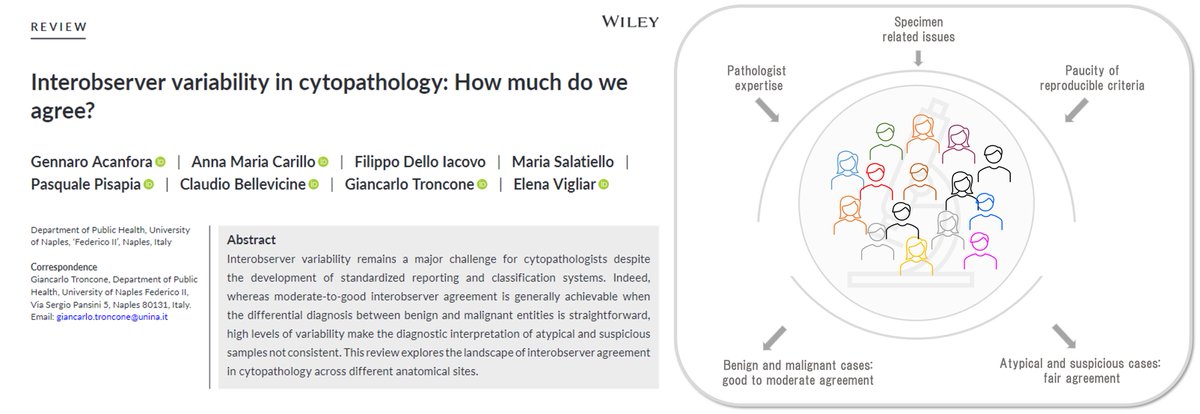 Elena Vigliar (@elena_vigliar) on Twitter photo Do you know how much we agree in cytopathology? Discover it in <a href="/CytopathologyJ/">Cytopathology</a>
onlinelibrary.wiley.com/doi/10.1111/cy… Do you know how much we agree in cytopathology? Discover it in <a href="/CytopathologyJ/">Cytopathology</a>
onlinelibrary.wiley.com/doi/10.1111/cy…