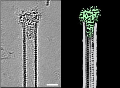 psychescope's tweet image. Harriet Saunders, Cyntha van de Berg, et al. show how ciliary tip proteins cooperate to make slow growing #microtubules in their new preprint! Together they form a structure that looks like a champagne cork in a #microtubule 😍 biorxiv.org/content/10.110…