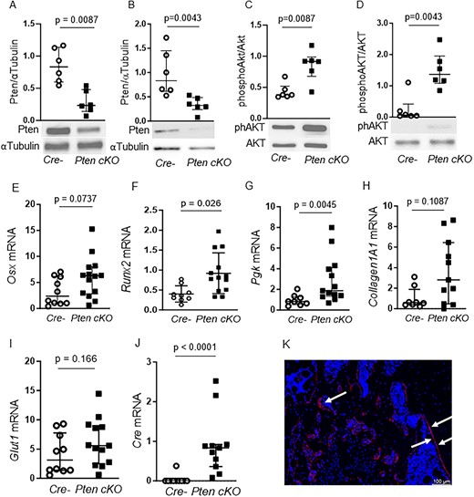 This #JBMR Plus study suggests that the absence of Pten in specific bone precursor cells leads to stronger and more flexible bones @antje_garten <a href="/Diana_Le_Duc/">Diana Le Duc</a> 

Read more here: ow.ly/Jaln50QLZwx