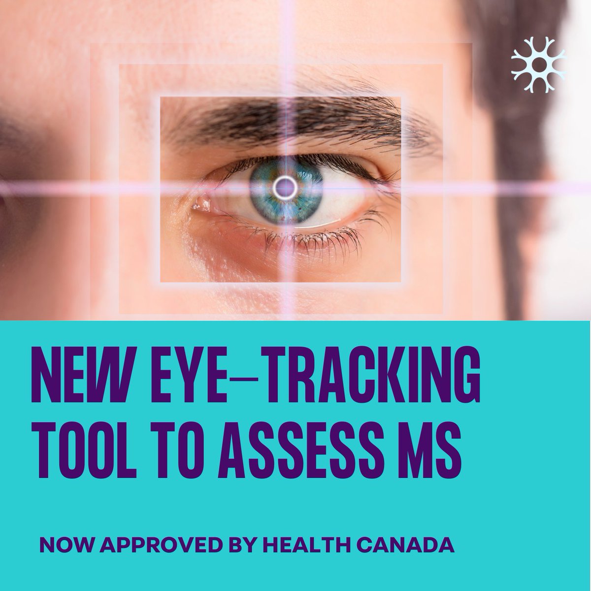 Health Canada has approved #ETNA eye-tracking software to assess #MS. An ongoing observational study at the CRU is testing if it could accurately predict #EDSS score. If successful, more sensitive, real-time biomarkers would be available to clinicians. cru.mcgill.ca/ms.