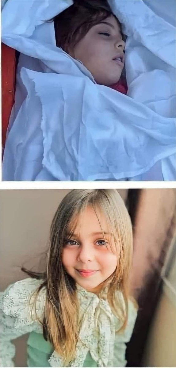 A girl from Gaza before and after