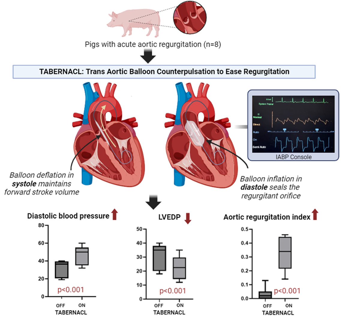 Have a patient dying from acute #aorticregurgitation ? TABERNACL might help. Connecting a valvuloplasty balloon to a IABP console can function as a counter-pulsation valve. Contact authors for help or report your experience ahajournals.org/doi/10.1161/CI… @CircIntv @TheBethesdaLabs