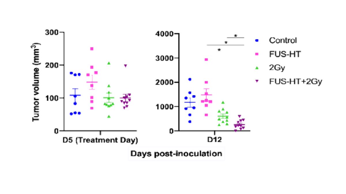 FUS as a radiosensitizer for glioblastoma. New work from my team at UVA in the journal Life.