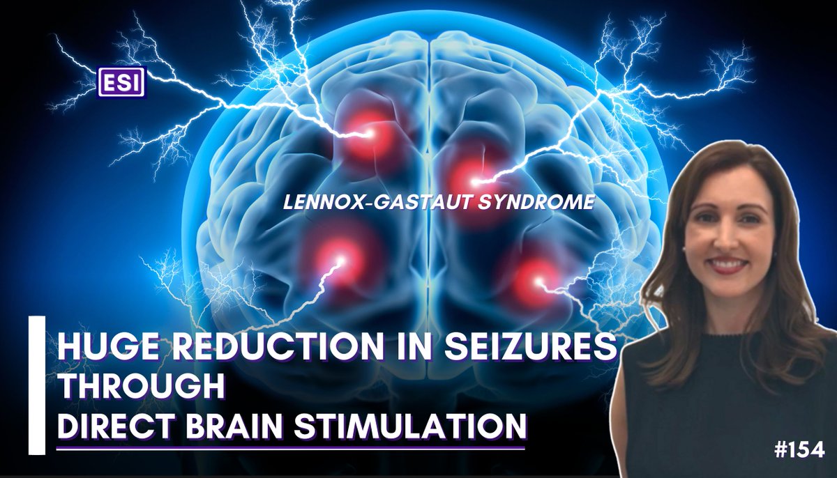 Check out the huuuuge seizure reduction in people with the rare #epilepsy 🧠⚡#LennnoxGastautSyndrome🧬 - when they have the palliative treatment/epilepsy surgery called Deep Brain Stimulation (#DBS)! With the amazing neurologist @drlindadalic from @Austin_Health 🇦🇺! 📹 YouTube