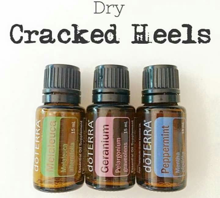 TeacherObie's tweet image. Cracked heels had me feeling like an alligator, but not anymore! 🐊✨ Found the holy grail with Tea Tree, Geranium, and Peppermint oils. Feet so smooth, I can&apos;t stop touching them! Who else is on this smooth heel journey? 🌿👣 #SmoothHeelsClub #EssentialOilMagic