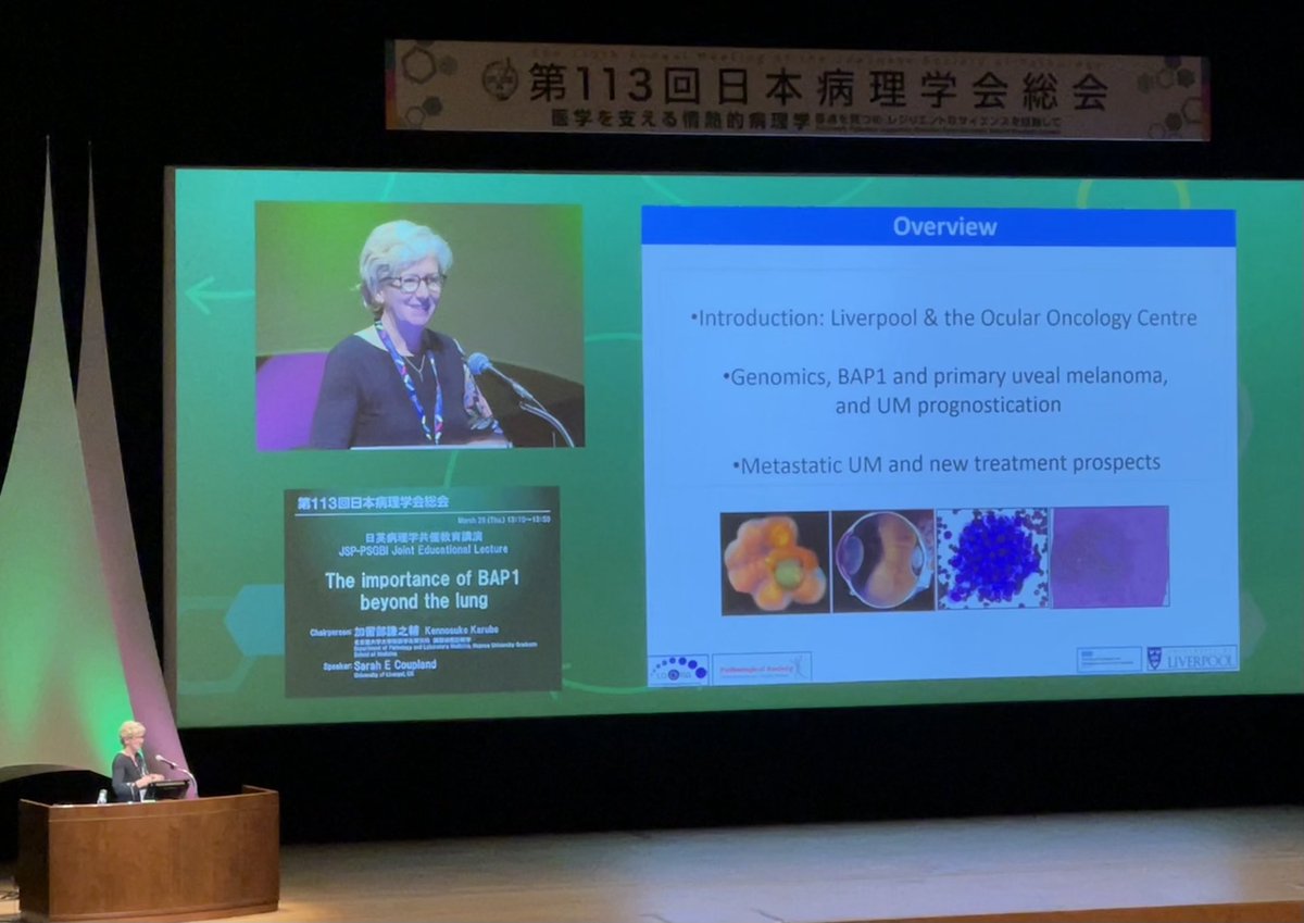 Sarah Coupland 💙🔬🚴🏻♂️📷 🇺🇦 (@sarahcoupland3) on Twitter photo I’d the pleasure of representing <a href="/pathsoc/">Pathological Society</a> & my research group to explain BAP1’s role in cancer, esp. uveal melanoma, at the Japanese Society of Pathology  <a href="/icanceresearch/">LOORG</a> <a href="/LivUni/">University of Liverpool</a> @LivHospitals <a href="/RCPath/">RC of Pathologists</a>  I’d the pleasure of representing <a href="/pathsoc/">Pathological Society</a> & my research group to explain BAP1’s role in cancer, esp. uveal melanoma, at the Japanese Society of Pathology  <a href="/icanceresearch/">LOORG</a> <a href="/LivUni/">University of Liverpool</a> @LivHospitals <a href="/RCPath/">RC of Pathologists</a> 
