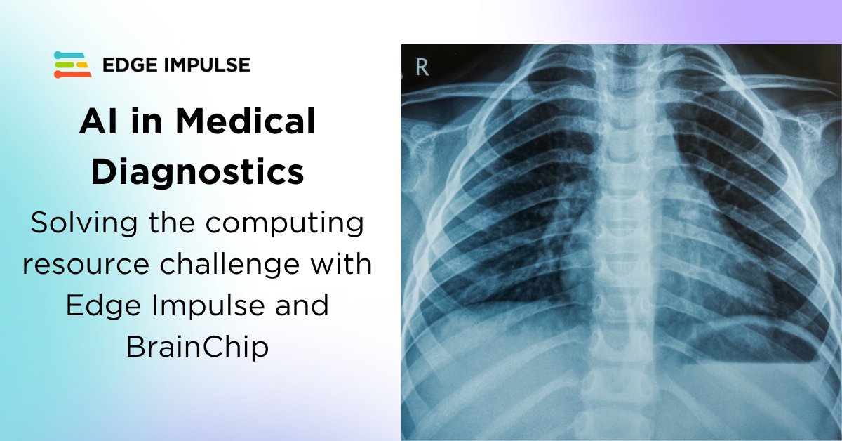 It’s no secret that #AI holds the promise of transforming healthcare delivery. Learn how Edge Impulse and <a href="/BrainChip_inc/">BrainChip</a> solved one of the key challenges surrounding patient data privacy and security in this use case. hubs.ly/Q02r2fGq0
 #edgeai #machinelearning #innovation