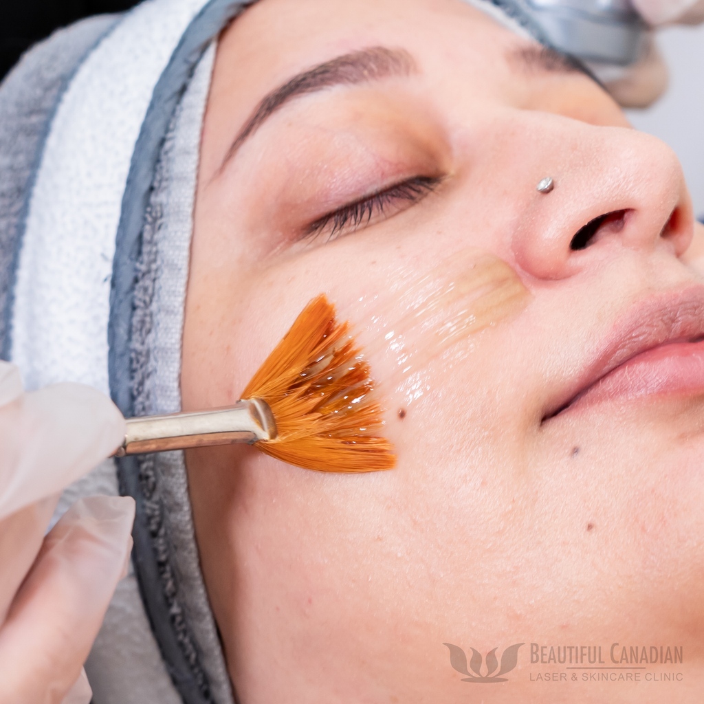 Get a customized facial, designed for your skin rejuvenation needs. For hydration, anti-aging, acne or otherwise, we've got medical-grade solutions that 'fit the bill'!

604 580 2464

l8r.it/cMSb

#facials #skincare #antiaging #acne #skinrejuvenation #beautytreatment