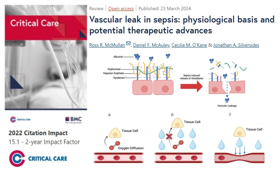 #CritCare #OpenAccess Vascular leak in sepsis: physiological basis and potential therapeutic advances Read the full article: ccforum.biomedcentral.com/articles/10.11… @jlvincen @ISICEM #FOAMed #FOAMcc