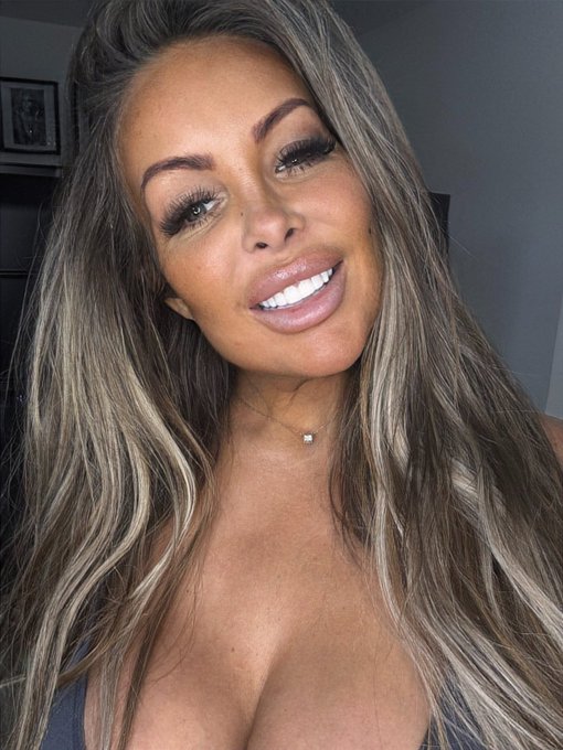 So obsessed with my new teeth https://t.co/xxdHsFWo2W