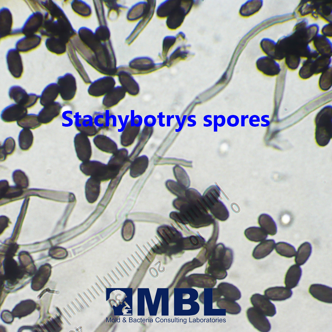 🍄 Stachybotrys, aka black mold, thrives in damp areas, common after floods or leaks. Its spores, linked to respiratory problems and allergies, spark debate over toxicity. Maintain a dry indoor space and address moisture promptly for a healthier environment. 
🍄