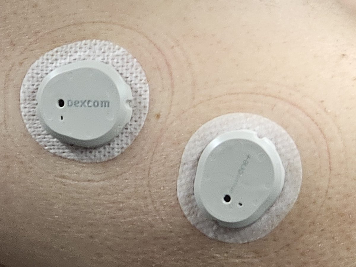Comparing Dexcom’s G7 and One+. Is there much difference? dlvr.it/T4lcz3