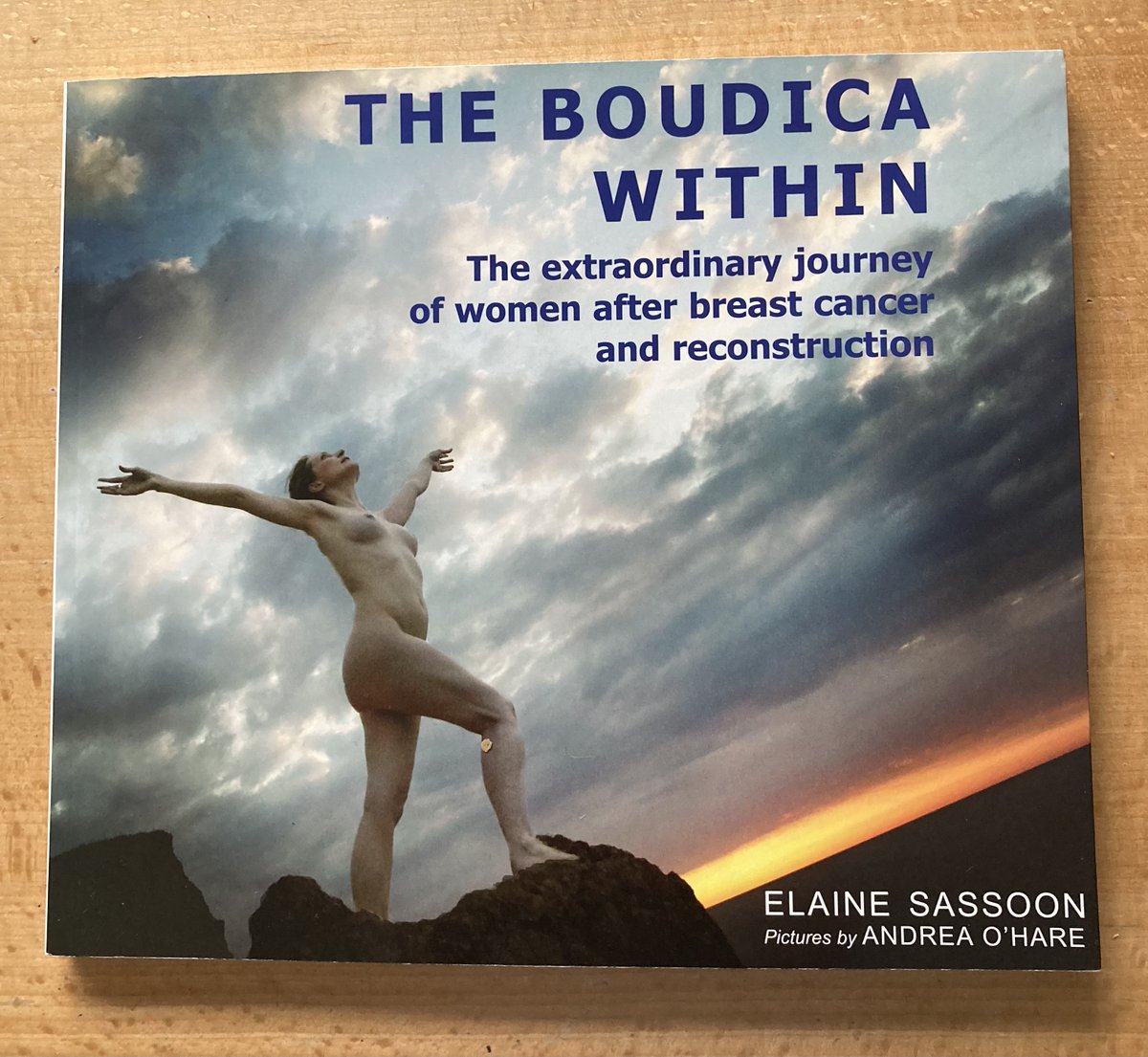 We're proud to support #breastreconstruction patients in many different ways from face-to-face Support Groups to conversations with our volunteers, info packs & relevant books. 'Thanks so much for the Boudica book; I'm really grateful for you sending that to me and good reading.'