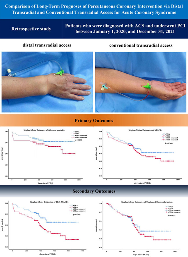 Distal or conventional #transradial access for PCI in #ACS patients? Data from long-term #outcomes comparison.

Free online: bit.ly/HJC_dTRA

<a href="/HCSgr/">HCS</a> <a href="/hjc_ed/">HJC Editor-in-Chief</a> #Radialfirst #myocardialinfarction #mortality #MACE #CardioEd #Cardiology