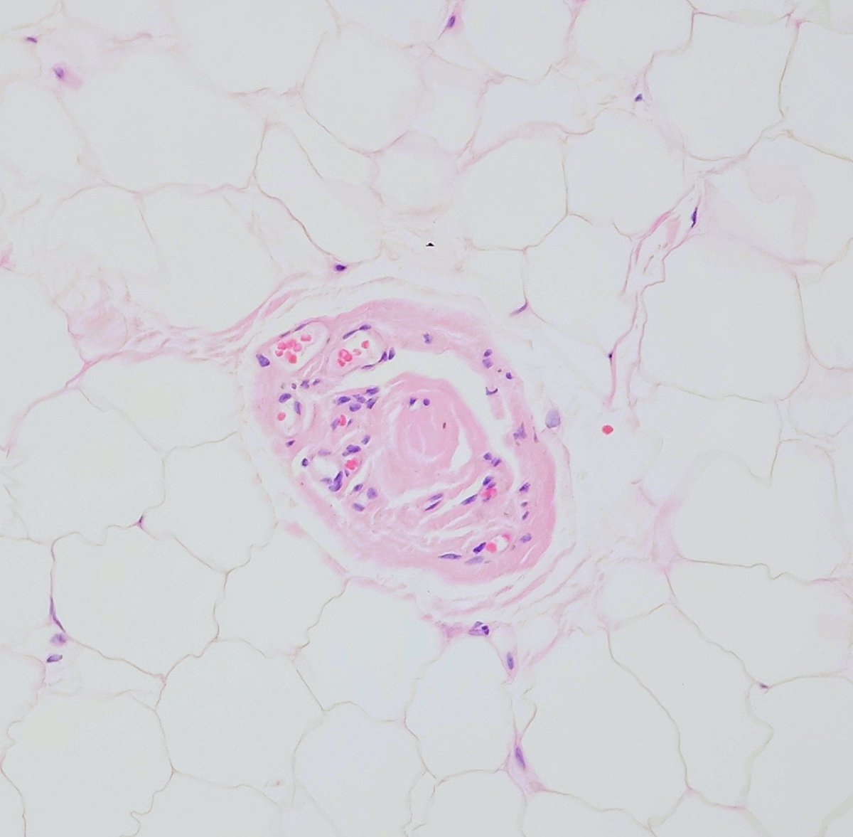 MBBS_Pathology tweet picture