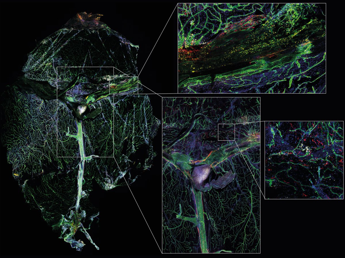 Friedman Brain Institute (@sinaibrain) on Twitter photo From major highways to little alleys in the meninges 🔬 <a href="/MatteoGianesel2/">Matteo Gianeselli, MD</a>, Mate Kiss & @alex_leunig. Here we can observe complete view of outermost meningeal layer called the dura mater. VOTE NOW for #ArtoftheBrain Image #37 Most💜s wins! VIRTUAL GALLERY shorturl.at/fELRX From major highways to little alleys in the meninges 🔬 <a href="/MatteoGianesel2/">Matteo Gianeselli, MD</a>, Mate Kiss & @alex_leunig. Here we can observe complete view of outermost meningeal layer called the dura mater. VOTE NOW for #ArtoftheBrain Image #37 Most💜s wins! VIRTUAL GALLERY shorturl.at/fELRX