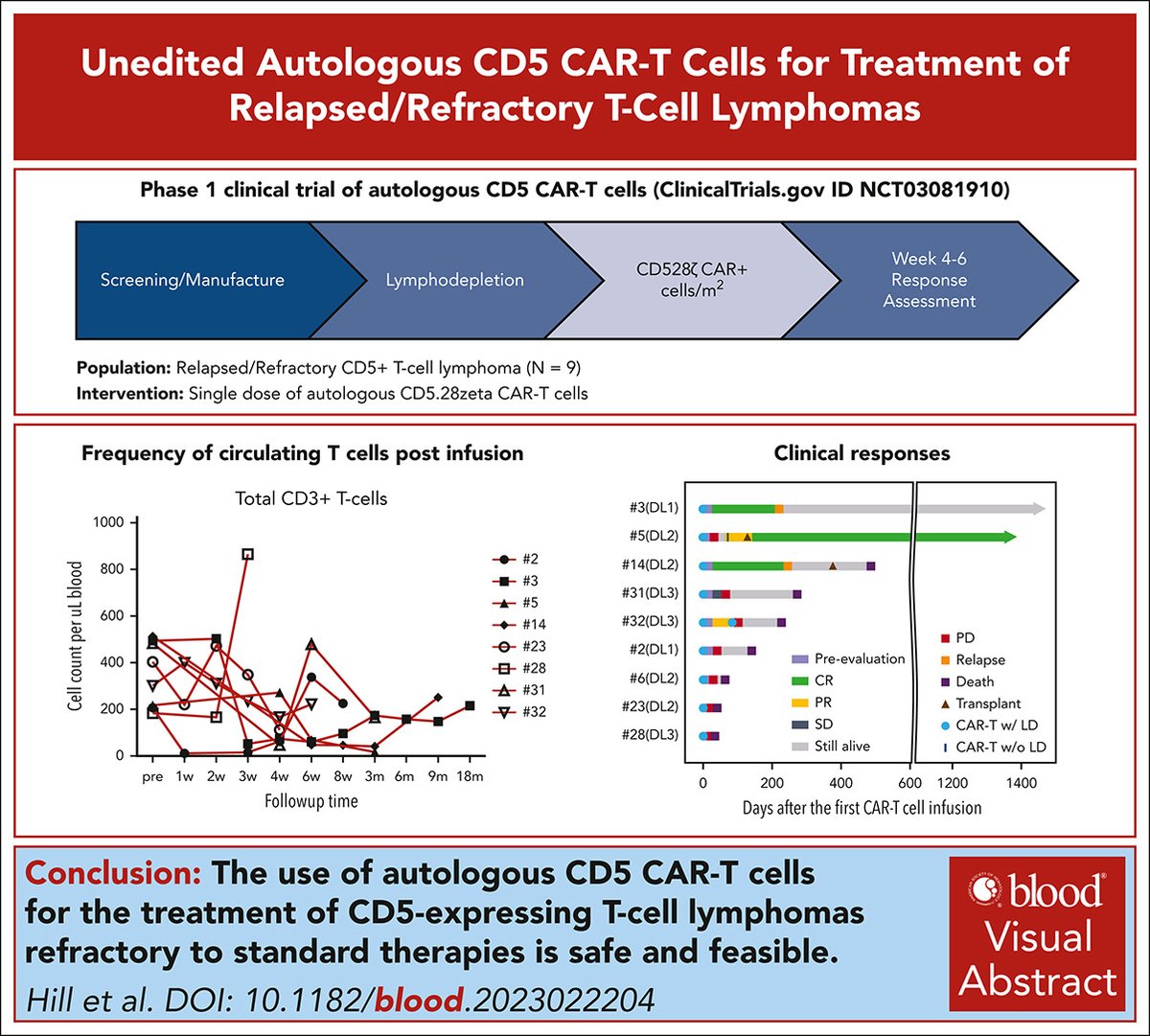 Excited to share first results of unedited CD5 CAR T in r/r T-cell lymphoma from a trial led by @HillLaQuisa and R.Rouce @CAGTHouston Infusions were safe and responses durable, with 2 pts still in CR 5+ years later. Multicenter Phase 2 later this year. sciencedirect.com/science/articl…