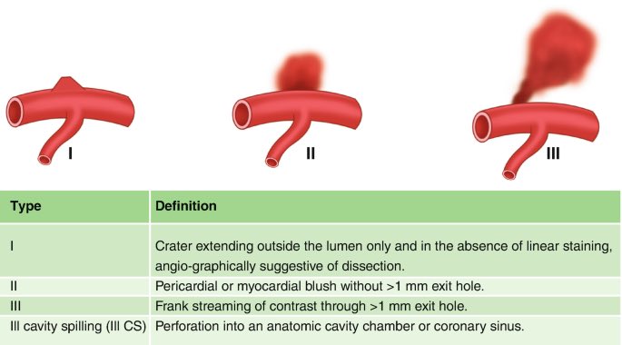 Neisser M tweet media