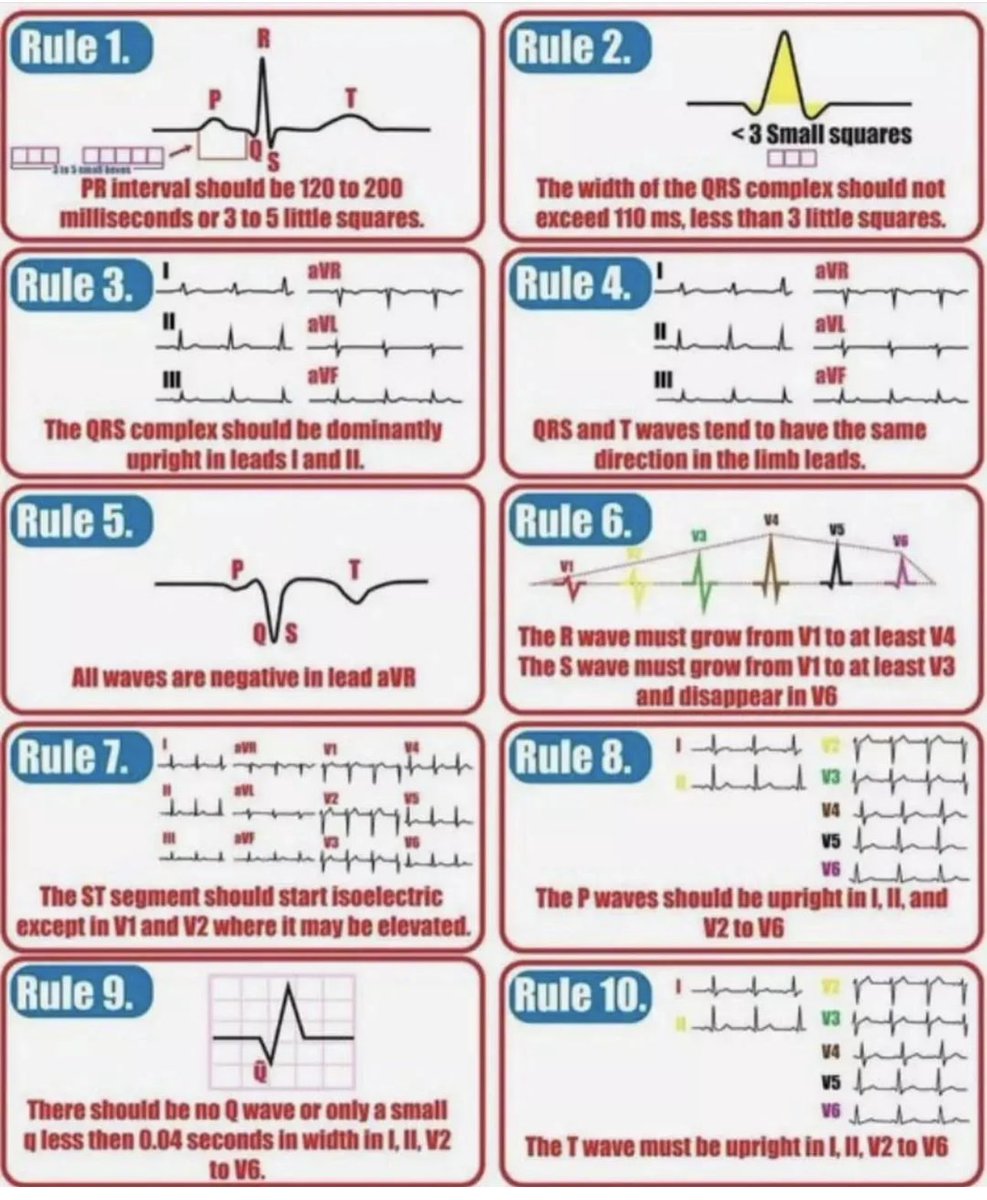 EKG Details