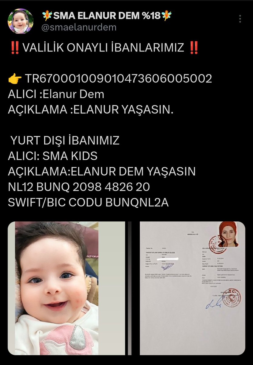 Elanur Bebeğimizin desteklerinize ihtiyacı var.