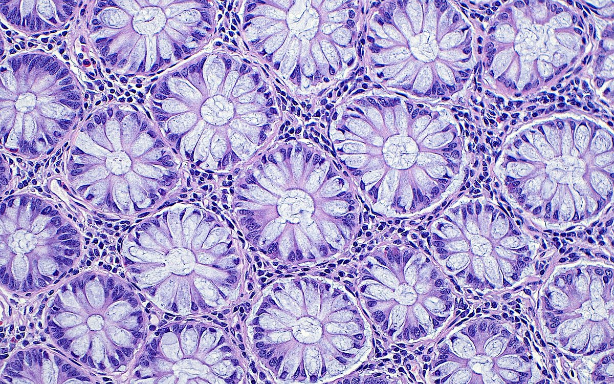 Daisies ~ 🌼 #PathArt