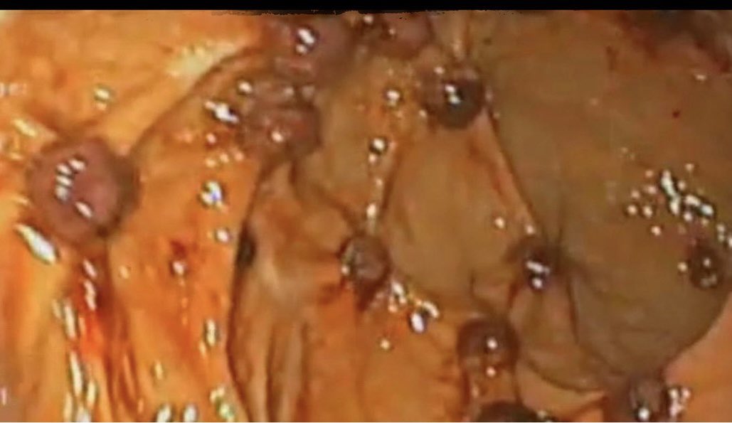 Keith Siau tweet media