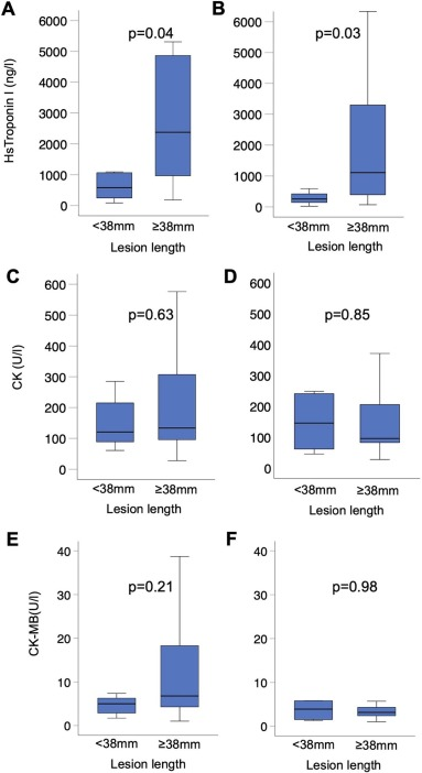 Just accepted in @CRMjournal+@ELS_Cardiology! Myocardial injury after orbital #Atherectomy and its association with coronary lesion length by Jakob Ledwoch et al. clinicalkey.com/#!/content/pla…