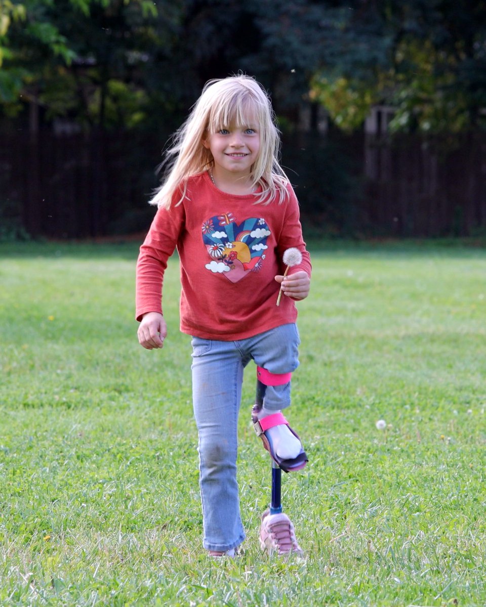 ShrinersNorCA's tweet image. It&apos;s Limb Loss &amp;amp; Limb Difference Awareness Month! 🌟
Elly was diagnosed with proximal focal femoral deficiency, causing one leg to be shorter. Thanks to @shrineranorca, she received an extension prosthesis to equalize her legs. 
#LimbDifferenceAwareness #ShrinersChildrens 🦵