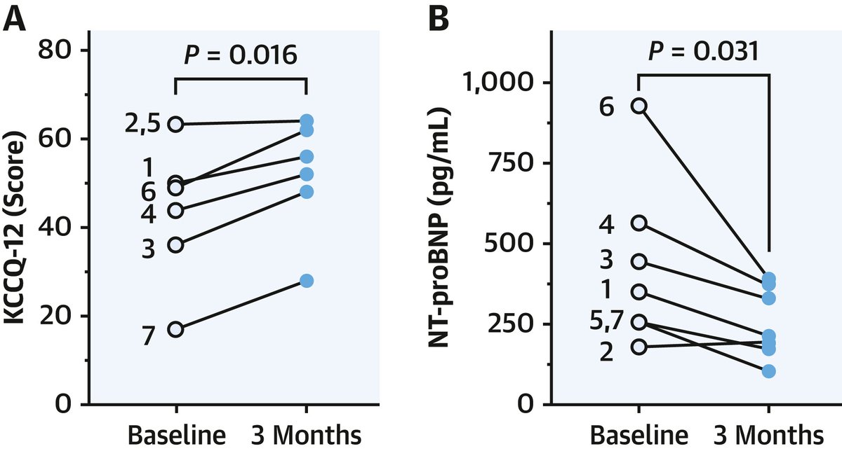 Personalized accelerated pacing for 3 months was safe & markedly improved: ✔️ HF-related health status ✔️ physical activity ✔️ peak exercise capacity ✔️ NT-proBNP levels ✔️ LA volumes In pts w/ nHCM w/ NYHA 2-3 symptoms & dual chamber ICDs bit.ly/4cVn2Sj #JACC #cvHCM