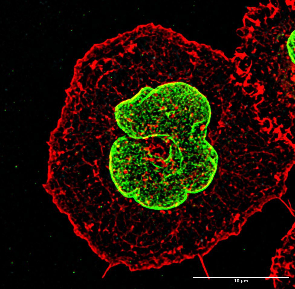 Peaceiton's tweet image. B Cell activation #FluorescentFriday #superresolution #bcell #phdlife