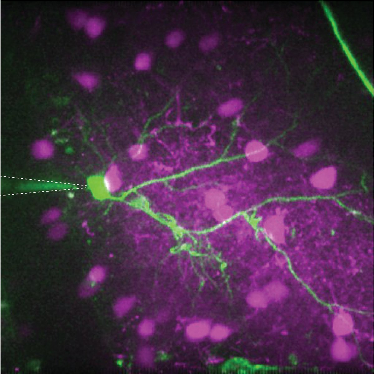 For today's #FluorescenceFriday: L2/3 pyramidal neuron (green) in mouse barrel cortex, filled through a patch pipette during an in vivo (awake) WC recording, surrounded by tdTomato-expressing PV interneurons (magenta).