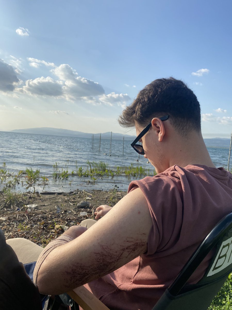 Ölümden dönünce erkekler 
<a href="/AyberkArsl16/">Ayberk</a>