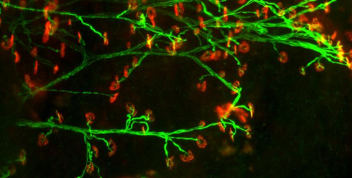 A small molecule inhibitor that targets the chloride channel CIC-1 can partially restore skeletal muscle function, strength, and motor neuron-muscle fiber crosstalk in rats with #MyastheniaGravis, and proves safe in patients in a phase 1 trial. @ScienceTM scim.ag/6zE