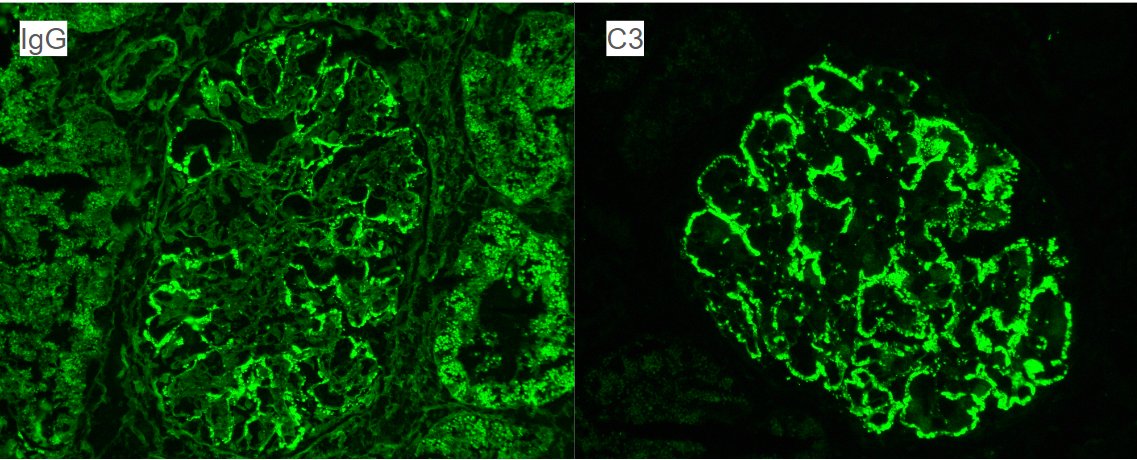 JZRenalPath tweet picture